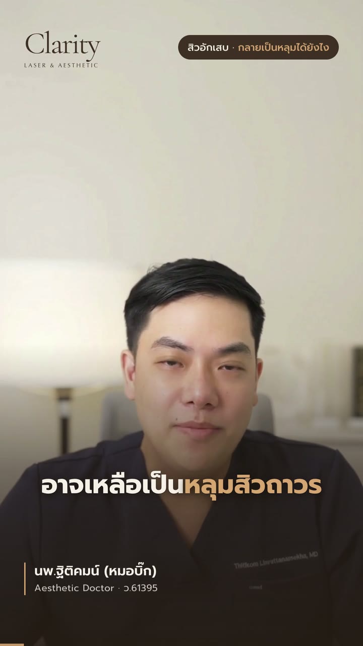 สิวอักเสบกลายเป็นหลุมสิวได้อย่างไร — สรุปใน 37 วินาที