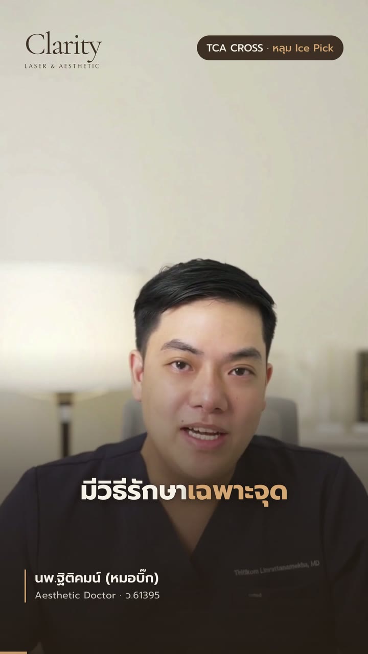 TCA CROSS รักษาหลุม Ice Pick ทำงานยังไง — สรุปใน 42 วินาที