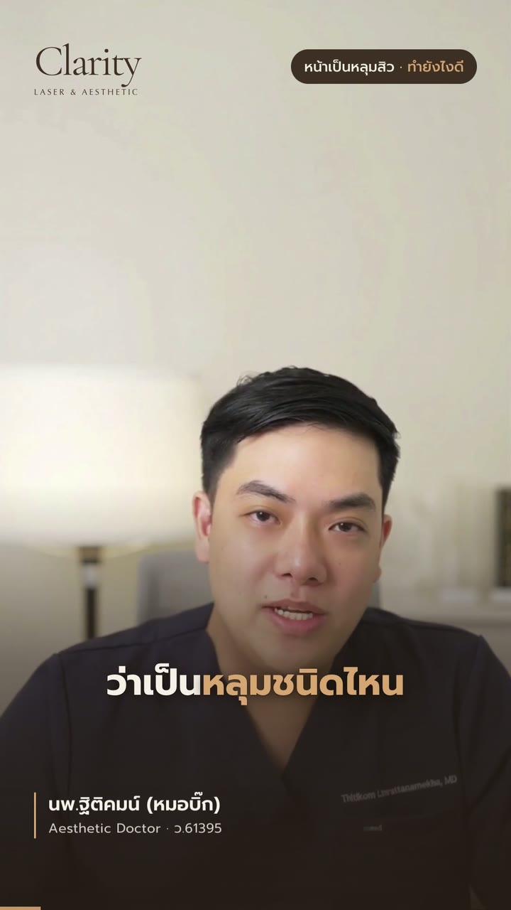 หลุมสิว 3 ชนิด ดูยังไง — สรุปใน 47 วินาที